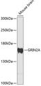 Glutamate Ionotropic Receptor NMDA Type Subunit 2A antibody, 15-236, ProSci, Western Blot image 