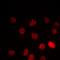 Peroxisome Proliferator Activated Receptor Gamma antibody, orb315656, Biorbyt, Immunofluorescence image 