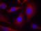 Nuclear Factor Kappa B Subunit 1 antibody, A00283-1, Boster Biological Technology, Immunofluorescence image 