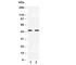 Mitogen-Activated Protein Kinase Kinase 7 antibody, R31022, NSJ Bioreagents, Western Blot image 