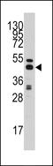 Adenosylhomocysteinase antibody, LS-C98603, Lifespan Biosciences, Western Blot image 