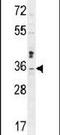 Metaxin 2 antibody, PA5-24284, Invitrogen Antibodies, Western Blot image 