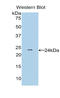 Catechol-O-Methyltransferase antibody, LS-C293236, Lifespan Biosciences, Western Blot image 