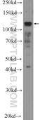 Promyelocytic Leukemia antibody, 21041-1-AP, Proteintech Group, Western Blot image 
