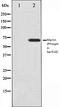 Cell Division Cycle 25A antibody, orb106113, Biorbyt, Western Blot image 