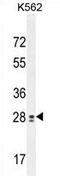 Testis Expressed 13B antibody, AP54222PU-N, Origene, Western Blot image 