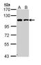 Catenin Alpha 1 antibody, PA5-29247, Invitrogen Antibodies, Western Blot image 