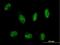 Myotubularin Related Protein 8 antibody, H00055613-B01P, Novus Biologicals, Immunocytochemistry image 