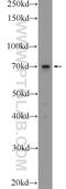 Transmembrane 9 Superfamily Member 4 antibody, 25595-1-AP, Proteintech Group, Western Blot image 