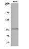 Myocardin Related Transcription Factor A antibody, orb161852, Biorbyt, Western Blot image 