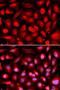 ETS Proto-Oncogene 1, Transcription Factor antibody, LS-B13365, Lifespan Biosciences, Immunofluorescence image 