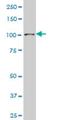 Sp3 Transcription Factor antibody, H00006670-M08, Novus Biologicals, Western Blot image 