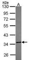 Thiosulfate Sulfurtransferase antibody, PA5-30196, Invitrogen Antibodies, Western Blot image 