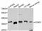 Cyclin D1 antibody, A11022, ABclonal Technology, Western Blot image 