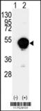 Cytochrome P450 Family 20 Subfamily A Member 1 antibody, 62-923, ProSci, Western Blot image 