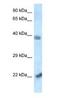Vacuolar Protein Sorting 72 Homolog antibody, NBP1-82385, Novus Biologicals, Western Blot image 