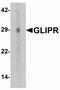 GLI Pathogenesis Related 1 antibody, NBP2-82032, Novus Biologicals, Western Blot image 