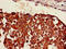 Sestrin 1 antibody, LS-C679436, Lifespan Biosciences, Immunohistochemistry paraffin image 