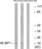 Eukaryotic Translation Initiation Factor 4E Binding Protein 1 antibody, LS-C118039, Lifespan Biosciences, Western Blot image 