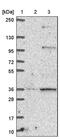 Reticulocalbin 3 antibody, PA5-60252, Invitrogen Antibodies, Western Blot image 