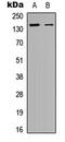 Sperm Associated Antigen 5 antibody, LS-C354410, Lifespan Biosciences, Western Blot image 