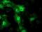 Striatin Interacting Protein 1 antibody, NBP2-45715, Novus Biologicals, Immunofluorescence image 