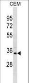 Phosphoribosyl Pyrophosphate Synthetase 1 Like 1 antibody, LS-C155843, Lifespan Biosciences, Western Blot image 