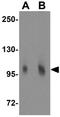 Matrilin 2 antibody, GTX31788, GeneTex, Western Blot image 
