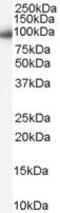 Karyopherin Subunit Beta 1 antibody, PA5-18450, Invitrogen Antibodies, Western Blot image 