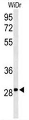 Nicotinamide Riboside Kinase 1 antibody, AP50690PU-N, Origene, Western Blot image 