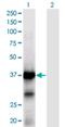 XPA, DNA Damage Recognition And Repair Factor antibody, H00007507-M01, Novus Biologicals, Western Blot image 