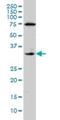 CD142 antibody, H00002152-M01, Novus Biologicals, Western Blot image 