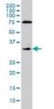 Coagulation Factor III, Tissue Factor antibody, H00002152-M01, Novus Biologicals, Western Blot image 