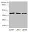 ATPase H+ Transporting Accessory Protein 2 antibody, LS-C369293, Lifespan Biosciences, Western Blot image 