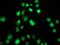 SAM And HD Domain Containing Deoxynucleoside Triphosphate Triphosphohydrolase 1 antibody, MA5-25316, Invitrogen Antibodies, Immunocytochemistry image 