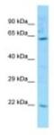 Liver carboxylesterase 31 antibody, NBP1-98271, Novus Biologicals, Western Blot image 