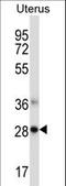 Nedd4 Family Interacting Protein 1 antibody, LS-C164786, Lifespan Biosciences, Western Blot image 
