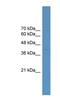 ETS Transcription Factor ELK4 antibody, NBP1-69129, Novus Biologicals, Western Blot image 