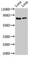 Forkhead Box P1 antibody, CSB-PA008841LA01HU, Cusabio, Western Blot image 