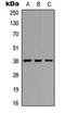 Eukaryotic Translation Initiation Factor 2 Subunit Beta antibody, LS-C354352, Lifespan Biosciences, Western Blot image 