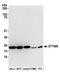 Deoxythymidylate Kinase antibody, A305-652A-M, Bethyl Labs, Western Blot image 