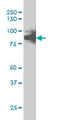 RAD17 Checkpoint Clamp Loader Component antibody, LS-C198052, Lifespan Biosciences, Western Blot image 