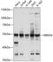 RNA Binding Motif Protein 34 antibody, GTX66000, GeneTex, Western Blot image 