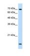 Ubiquitin Conjugating Enzyme E2 L3 antibody, orb330275, Biorbyt, Western Blot image 