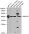 Mitogen-Activated Protein Kinase 13 antibody, GTX64610, GeneTex, Western Blot image 