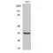 Cyclin Dependent Kinase 1 antibody, LS-C382609, Lifespan Biosciences, Western Blot image 