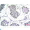 Thrombospondin 2 antibody, LS-C813522, Lifespan Biosciences, Immunohistochemistry paraffin image 