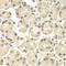 Plasminogen Activator, Urokinase antibody, orb136091, Biorbyt, Immunohistochemistry paraffin image 