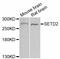 SET Domain Containing 2, Histone Lysine Methyltransferase antibody, abx126535, Abbexa, Western Blot image 