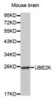 Ubiquitin Conjugating Enzyme E2 K antibody, abx000798, Abbexa, Western Blot image 
